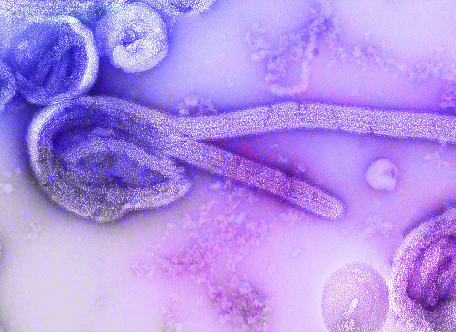Le Congo et l’Ouganda signalent 263 cas confirmés d’Ebola et 43 décès Cartographie de la zone touchée par l'épidémie d'Ébola en Ituri