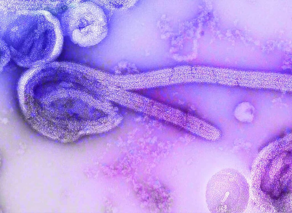 Premier cas d'Ebola confirmé en France
